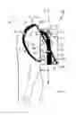 Fig. 17 - Backpack