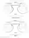 Fig. 02 - Knee pillow