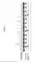 Fig. 11 - Endoscope system