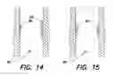 Fig. 09 - RIGID HEAD FOR A BODY PASSAGE DEVICE
