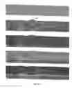 Fig. 07 - Predicting retinal degeneration based on three-dimensional modeling of oxygen concentration