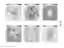Fig. 08 - Predicting retinal degeneration based on three-dimensional modeling of oxygen concentration
