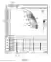 Fig. 11 - System and method for diagnosing arrhythmias and directing catheter therapies