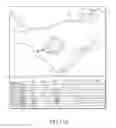 Fig. 12 - System and method for diagnosing arrhythmias and directing catheter therapies