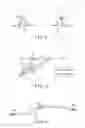 Fig. 06 - Medical instrument