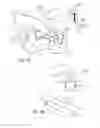 Fig. 09 - PATIENT-SPECIFIC GUIDES TO IMPROVE POINT REGISTRATION ACCURACY IN SURGICAL NAVIGATION