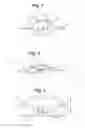 Fig. 02 - BLOOD GLUCOSE MANAGEMENT
