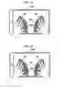 Fig. 12 - Brain dysfunction assessment method, brain dysfunction assessment device, and program thereof