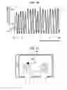 Fig. 13 - Brain dysfunction assessment method, brain dysfunction assessment device, and program thereof