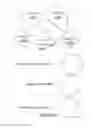 Fig. 15 - Automated systems and methods for skin assessment and early detection of a latent pathogenic bio-signal anomaly
