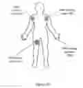 Fig. 21 - Automated systems and methods for skin assessment and early detection of a latent pathogenic bio-signal anomaly