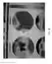 Fig. 04 - Real time brain trauma treatment
