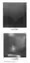 Fig. 18 - Access needle with direct visualization and related methods