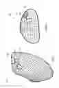 Fig. 02 - Methods, devices, and systems for obesity treatment