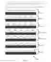 Fig. 12 - SYSTEM AND METHOD FOR RESPIRATORY SYSTEM ASSESSMENT