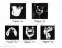 Fig. 08 - Periodontal disease testing apparatus and image processing program used therein
