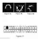 Fig. 10 - Periodontal disease testing apparatus and image processing program used therein