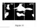 Fig. 14 - Periodontal disease testing apparatus and image processing program used therein