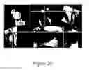 Fig. 18 - Periodontal disease testing apparatus and image processing program used therein