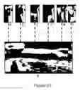 Fig. 22 - Periodontal disease testing apparatus and image processing program used therein