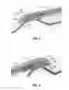 Fig. 04 - Methods and devices for vein harvesting