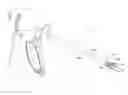 Fig. 01 - Methods and devices for vein harvesting