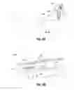 Fig. 08 - Methods and devices for vein harvesting