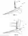 Fig. 04 - Methods and instruments for subchondral treatment of osteoarthritis in a small joint