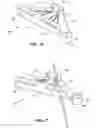 Fig. 09 - Methods and instruments for subchondral treatment of osteoarthritis in a small joint