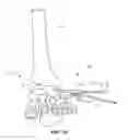 Fig. 14 - Methods and instruments for subchondral treatment of osteoarthritis in a small joint