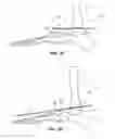 Fig. 15 - Methods and instruments for subchondral treatment of osteoarthritis in a small joint