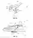 Fig. 18 - Methods and instruments for subchondral treatment of osteoarthritis in a small joint