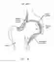 Fig. 07 - Method and apparatus for re-attaching the labrum to the acetabulum, including the provision and use of a novel suture anchor system