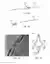 Fig. 04 - METHODS, SYSTEMS AND DEVICES FOR TREATING ERECTILE DYSFUNCTION