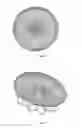 Fig. 05 - Left atrial appendage occluder