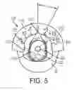 Fig. 08 - Patient-specific femoral version guide