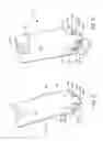 Fig. 09 - Surgical blade for use with an acetabular cup remover to remove bone around an acetabular cup