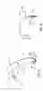 Fig. 15 - Surgical blade for use with an acetabular cup remover to remove bone around an acetabular cup
