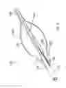 Fig. 05 - Over-the-Wire-Valvulotomes