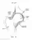 Fig. 07 - Method and apparatus for accessing the interior of a hip joint, including the provision and use of a novel telescoping access cannula and a novel telescoping obturator