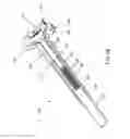 Fig. 33 - Method and apparatus for accessing the interior of a hip joint, including the provision and use of a novel telescoping access cannula and a novel telescoping obturator