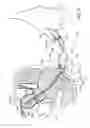 Fig. 09 - Uterine manipulators and related components and methods