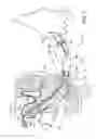 Fig. 09 - Uterine manipulators and related components and methods