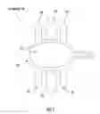 Fig. 02 - Minimally invasive interspinous process spacer implants and methods