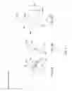 Fig. 10 - Minimally invasive interspinous process spacer implants and methods