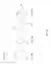 Fig. 19 - Minimally invasive interspinous process spacer implants and methods