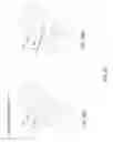 Fig. 26 - Minimally invasive interspinous process spacer implants and methods