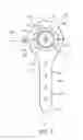 Fig. 04 - Device for performing a surgical procedure and method