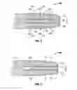 Fig. 04 - Surgical tissue sealer