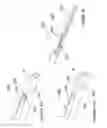 Fig. 15 - Methods for renal neuromodulation